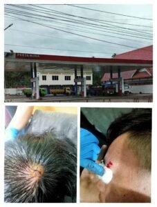 SPBU Milik Bupati Minahasa Tenggara Ronald Kandoli Jadi Sarang Mafia Solar, Sopir Truk Jadi Korban Penganiayaan Mafia Solar